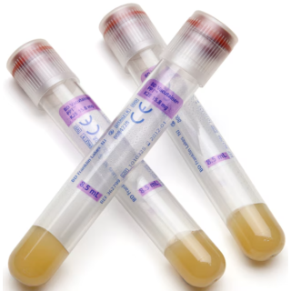 BD  # 362799 - Vacutainer Tube White K2 EDTA 16x100mm Sterile Blood Collection Tube for Plasma and Hematology Testing, 100/BX, 10 BX/CS (Temp Sensitive; Non-Returnable) (Continental US Only)