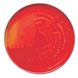 BD  # 221161 - QC Antigen Alkalescens  Quality Control Reagent for Serological Testing