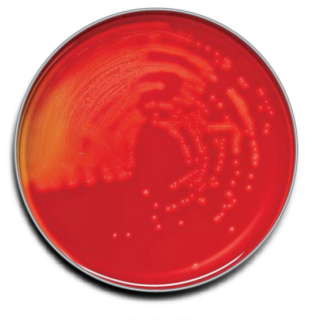 BD  # 221261 - BBL Trypticase Soy Agar with 5% Sheep Blood, Differential Culture Plates