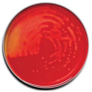 BD  # 212305 - TSA II  Tryptic Soy Agar II Dehydrated Medium for General Microbial Cultivation