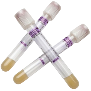 BD  # 362788 - PPT EDTA Tube, 13mm x 100mm, 5.0mL, Plasma Preparation Tube with See-Thru Label, 100/PK, 10 PK/CS (Temp Sensitive; Non-Returnable) (Continental US Only) (Item on Manufacturer Allocation - Inventory is Limited when Available)