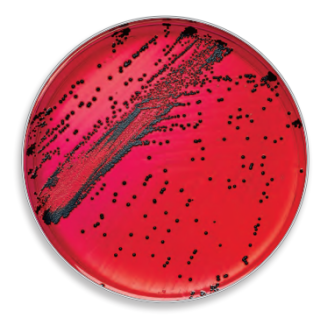 BD  # 221284 - BBL Prepared XLD Agar Plates, 500g  Selective Differential Medium for Enteric Pathogen Isolation, 100/PK