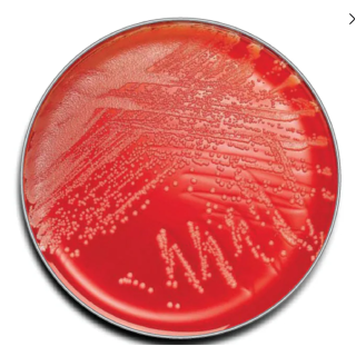 BD  # 221263 - Columbia Agar with 5% Sheep Blood  Enriched Medium for Fastidious Organism Isolation