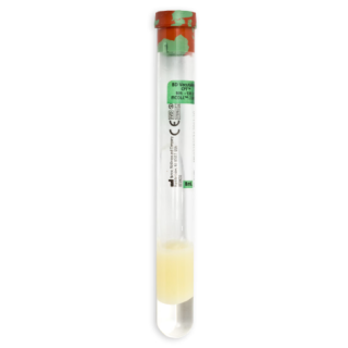 BD  # 362761 - CPT Sodium Citrate Tube 16mm x 125mm, 8.0mL  Cell Preparation Tube for Plasma and Mononuclear Cell Separation, 60/CS