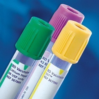 BD  # 367862 - Vacutainer K2 EDTA Tube 4mL 13x75mm  Lavender Stopper, Whole Blood Collection, 1000/CS