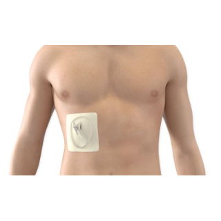 BD  # 50-7270 - PleurX Emergency Valve Replacement Kit for Pleural and Peritoneal Drainage Systems, 5/CS (Continental US Only)