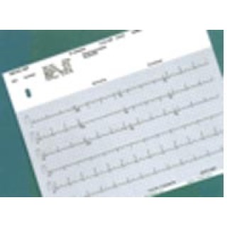 Precision Charts # 007957 - PAPER, ECG, BURDICK, 50WX150L, BLK, GRID, 50 RL/CS