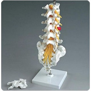 Sammons Preston # 928194 - LUMBAR SECTION W/HERNIATED DSK, EACH
